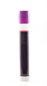 Whole Blood Vacutainer Tube Collections, Multiple Myeloma, Fresh
