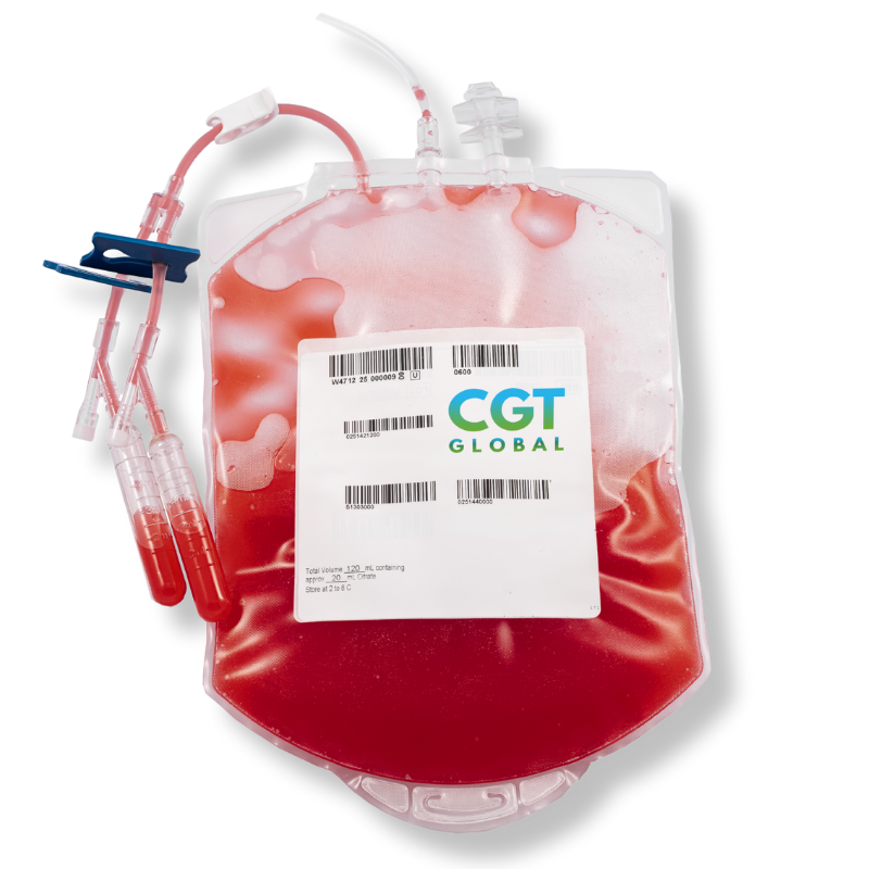Leukopak product containing concentrated peripheral blood mononuclear cells (PBMCs) for cell therapy and immunology research