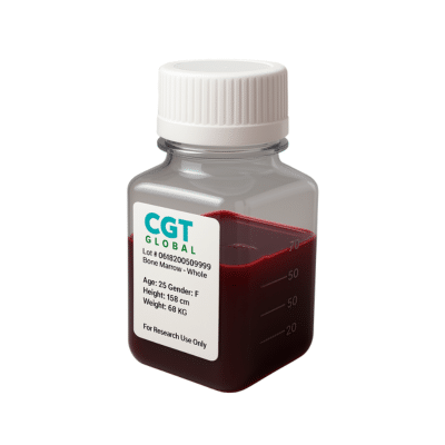 Bone Marrow CGT Global