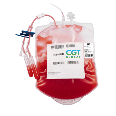 “Mobilized leukopak collected with G-CSF and Plerixafor, providing high CD34+ stem cell yield for clinical research”
